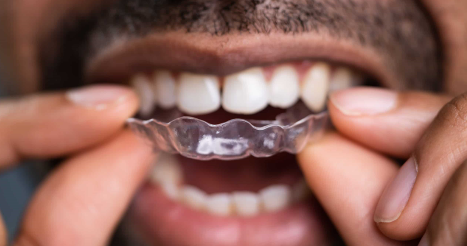 Best orthodontists in South Africa